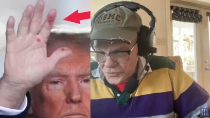 📺 ‘This Man Has the Clap!’ James Carville Insists Trump’s Hand Sores Show ‘Secondary Syphilis’ (mediaite.com)